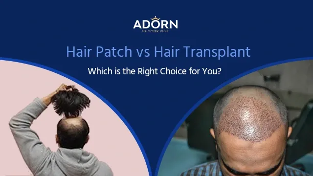 Hair Patch / Hair wig in Ahmedabad 