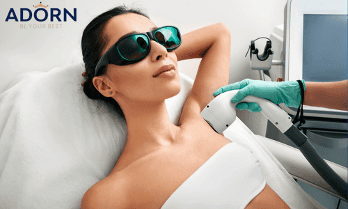 Full Body Laser Hair Removal Cost in India (2025): Detailed Guide, Pricing in Ahmedabad