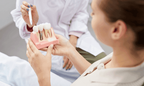 Dental Implant: Teeth Should Always Be in Style